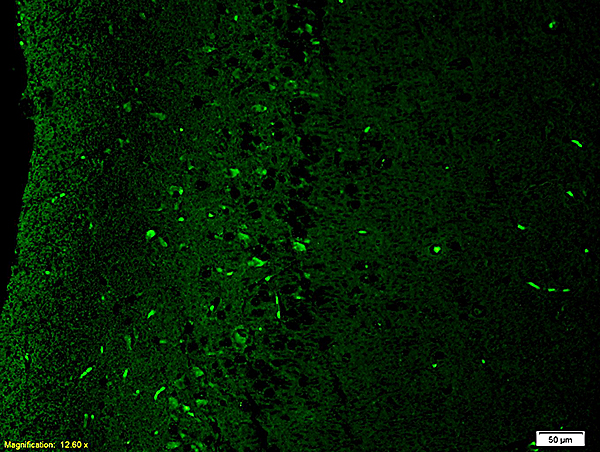 Formalin-fixed and paraffin embedded: rat brain tissue labeled with Anti-NR2B\/NMDAR2B Polyclonal Antibody, Unconjugated (bs-0222R) at 1:200,, followed by conjugation to the secondary antibody was Goat Anti-Rabbit IgG, FITC conjugated(bs-0295G-FITC) at 1:200 for 40 minutes at 37\u00b0C