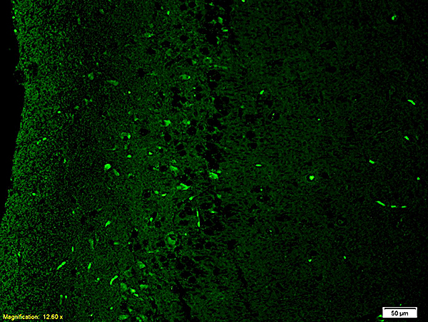 Formalin-fixed and paraffin embedded: rat brain tissue labeled with Anti-NR2B/NMDAR2B Polyclonal Antibody, Unconjugated (bs-0222R) at 1:200,, followed by conjugation to the secondary antibody was Goat Anti-Rabbit IgG, FITC conjugated(bs-0295G-FITC) at 1:200 for 40 minutes at 37°C