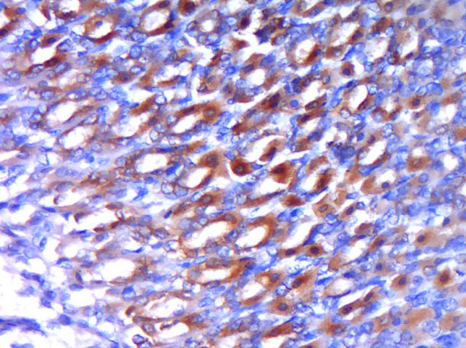 Paraformaldehyde-fixed, paraffin embedded Rat stomach; Antigen retrieval by boiling in sodium citrate buffer (pH6.0) for 15min; Block endogenous peroxidase by 3% hydrogen peroxide for 20 minutes; Blocking buffer (normal goat serum) at 37°C for 30min; Antibody incubation with SOX2 Polyclonal Antibody, Unconjugated (bs-23177R) at 1:400 overnight at 4°C, DAB staining.