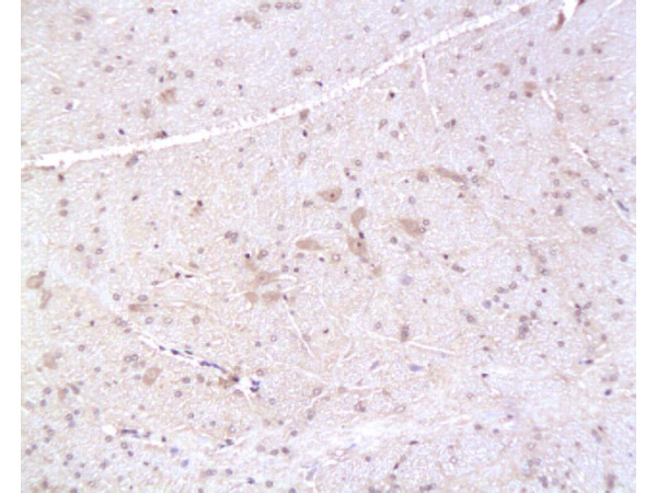 Formalin-fixed and paraffin embedded: rat brain tissue labeled with Anti-PMP22 Polyclonal Antibody, Unconjugated (bs-0235R) at 1:200, followed by conjugation to the secondary antibody and DAB staining Formalin-fixed and paraffin embedded: rat brain tissue labeled with Anti-PMP22 Polyclonal Antibody, Unconjugated (bs-0235R) at 1:200, followed by conjugation to the secondary antibody and DAB staining
