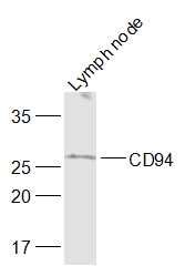 Mouse lymph node lysates probed with CD94 Polyclonal Antibody, Unconjugated (bs-2521R) at 1:1000 dilution and 4˚C overnight incubation. Followed by conjugated secondary antibody incubation at 1:10000 for 60 min at 37˚C.