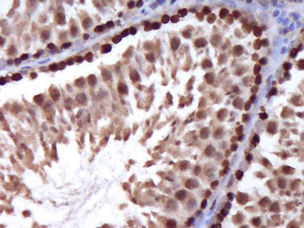 Paraformaldehyde-fixed, paraffin embedded Rat testis; Antigen retrieval by boiling in sodium citrate buffer (pH6.0) for 15min; Block endogenous peroxidase by 3% hydrogen peroxide for 20 minutes; Blocking buffer normal goat serum at 37°C for 30min; Antibody incubation with Stra8 Polyclonal Antibody, Unconjugated bs-1903R at 1:400 overnight at 4°C, followed by a conjugated secondary antibody and DAB staining.