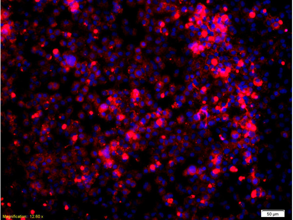 Formalin-fixed and paraffin embedded: human lung epithelial cells labeled with Anti-Glucocorticoid receptor(GR) Polyclonal Antibody, Unconjugated (bs-0252R) at 1:200,, followed by conjugation to the secondary antibody was Goat Anti-Rabbit IgG, PE conjugated(bs-0295G-PE) at 1:200 for 40 minutes at 37°C