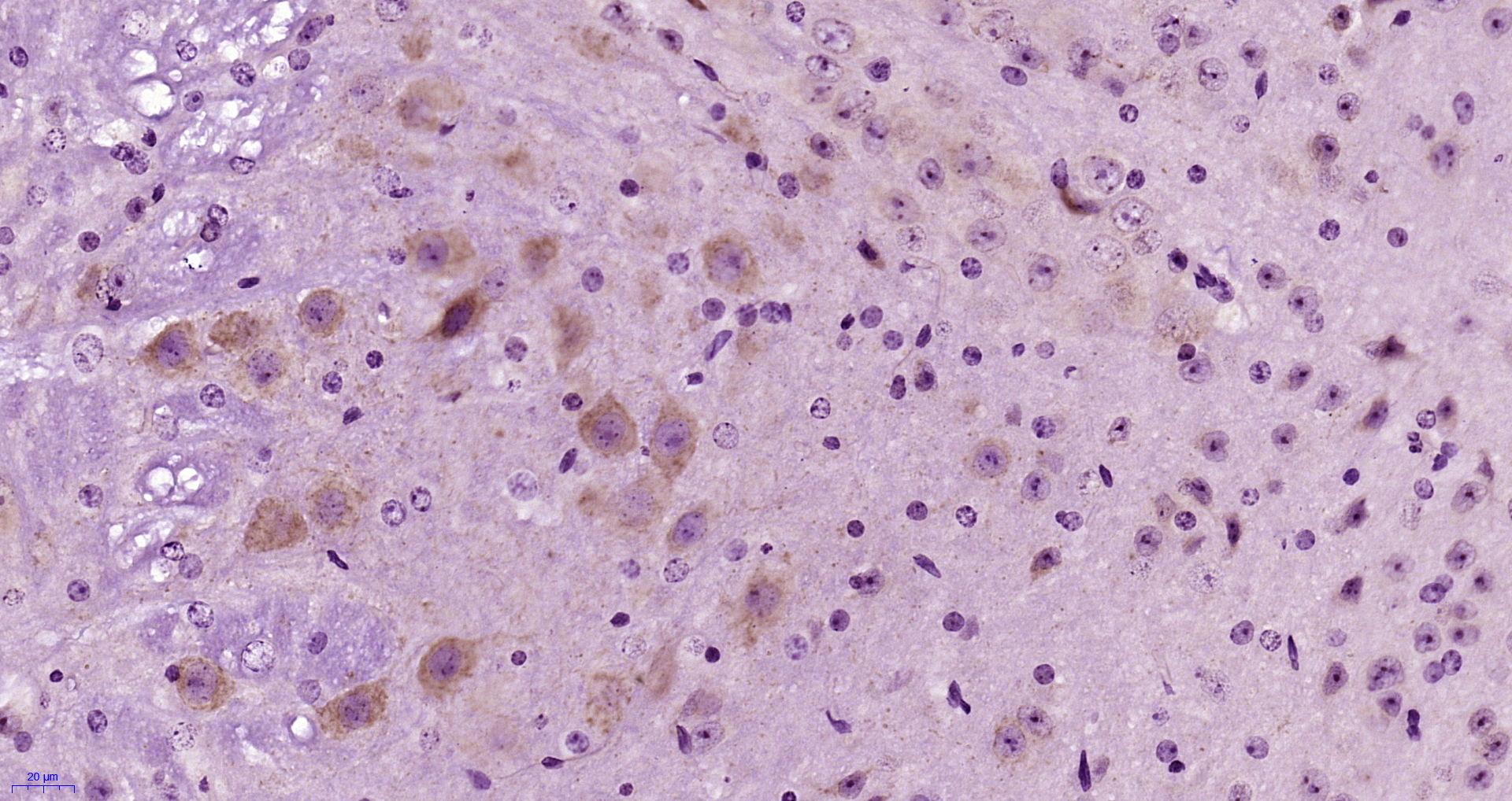 Paraformaldehyde-fixed, paraffin embedded Mouse brain; Antigen retrieval by boiling in sodium citrate buffer (pH6.0) for 15min; Block endogenous peroxidase by 3% hydrogen peroxide for 20 minutes; Blocking buffer (normal goat serum) at 37°C for 30min; Antibody incubation with SCD1 Polyclonal Antibody, Unconjugated (bs-3787R) at 1:400 overnight at 4°C, DAB staining.