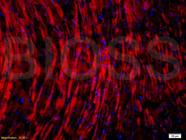 Formalin-fixed and paraffin embedded: rat brain tissue labeled with Anti-Glucocorticoid receptor(GR) Polyclonal Antibody, Unconjugated (bs-0252R) at 1:200,, followed by conjugation to the secondary antibody was Goat Anti-Rabbit IgG, PE conjugated(bs-0295G-PE) at 1:200 for 40 minutes at 37°C Formalin-fixed and paraffin embedded: rat brain tissue labeled with Anti-Glucocorticoid receptor(GR) Polyclonal Antibody, Unconjugated (bs-0252R) at 1:200,, followed by conjugation to the secondary antibody was Goat Anti-Rabbit IgG, PE conjugated(bs-0295G-PE) at 1:200 for 40 minutes at 37°C