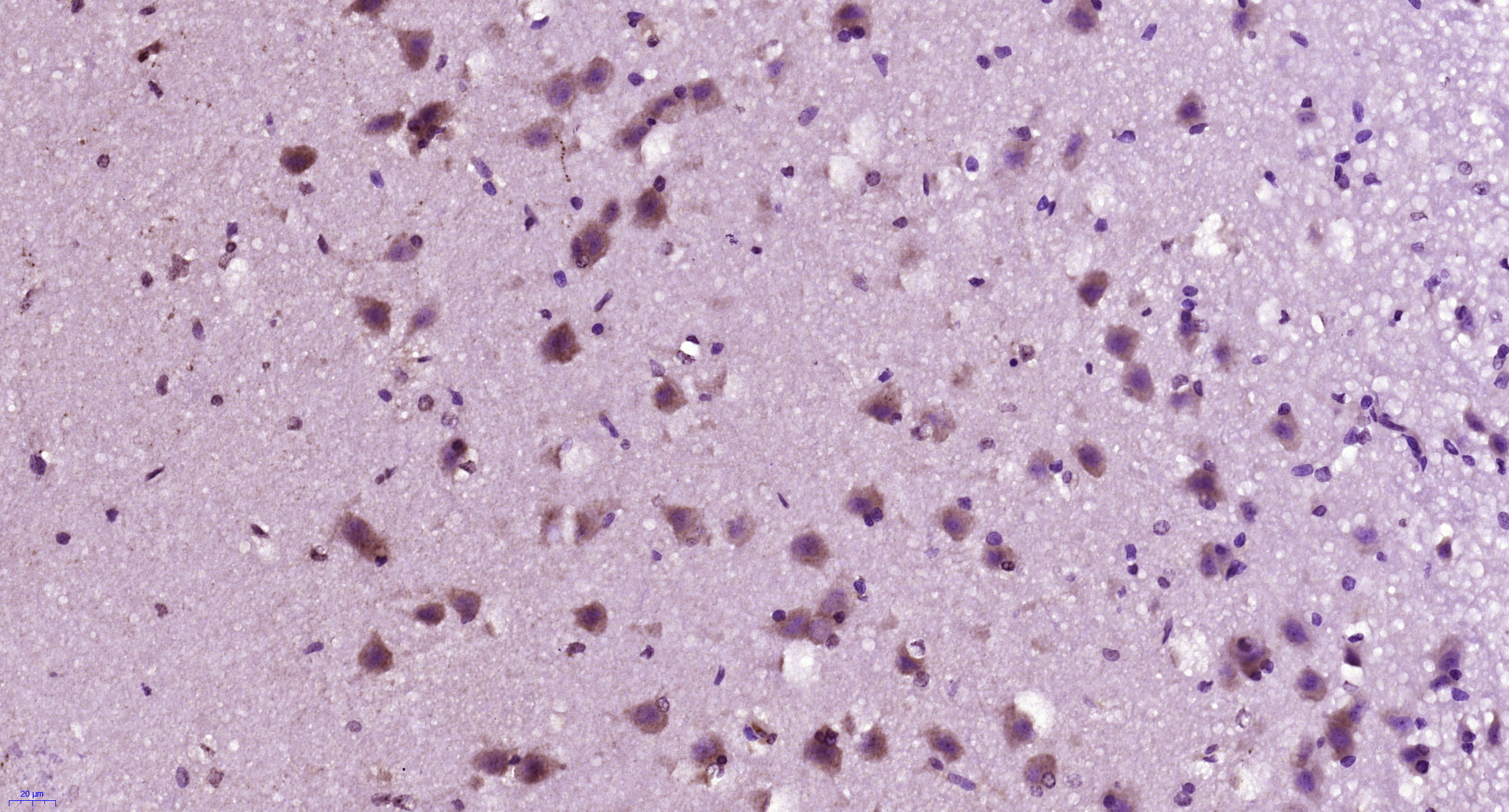 Paraformaldehyde-fixed, paraffin embedded Rabbit brain; Antigen retrieval by boiling in sodium citrate buffer (pH6.0) for 15min; Block endogenous peroxidase by 3% hydrogen peroxide for 20 minutes; Blocking buffer (normal goat serum) at 37°C for 30min; Antibody incubation with LOX 1 Polyclonal Antibody, Unconjugated (bs-2044R) at 1:400 overnight at 4°C, DAB staining.