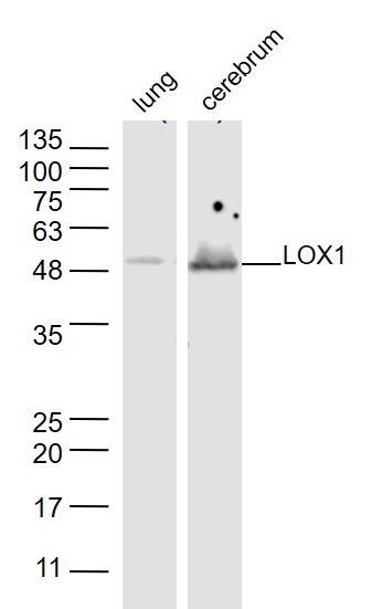 Lane 1: Mouse lung lysates; Lane 2: Mouse cerebrum lysates; probed with LOX 1 Polyclonal Antibody, unconjugated (bs-2044R) at 1:1000 overnight at 4°C followed by a conjugated secondary antibody for 60 minutes at 37°C.