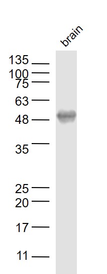 Rabbit brain lysates; probed with LOX 1 Polyclonal Antibody, unconjugated (bs-2044R) at 1:1000 overnight at 4°C followed by a conjugated secondary antibody for 60 minutes at 37°C.