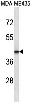 MDA-MB435 Cell lysates; probed with LHX2 (5C1) Monoclonal Antibody, unconjugated (bsm-51079M) overnight at 4°C followed by a conjugated secondary antibody.