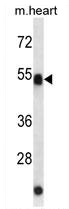 Mouse heart lysates; probed with ATG4C (7C2) Monoclonal Antibody, unconjugated (bsm-51084M) overnight at 4°C followed by a conjugated secondary antibody.
