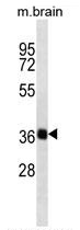 Mouse brain lysates probed with SYP (8C4) Monoclonal Antibody, unconjugated (bsm-51093M) overnight at 4°C followed by a conjugated secondary antibody.