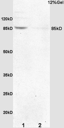 Formalin-fixed and paraffin embedded mouse embryo labeled with Anti-p95 NBS1/Cell cycle regulatory protein p95 Polyclonal Antibody, Unconjugated (bs-6124R) at 1:200 followed by conjugation to the secondary antibody and DAB staining.