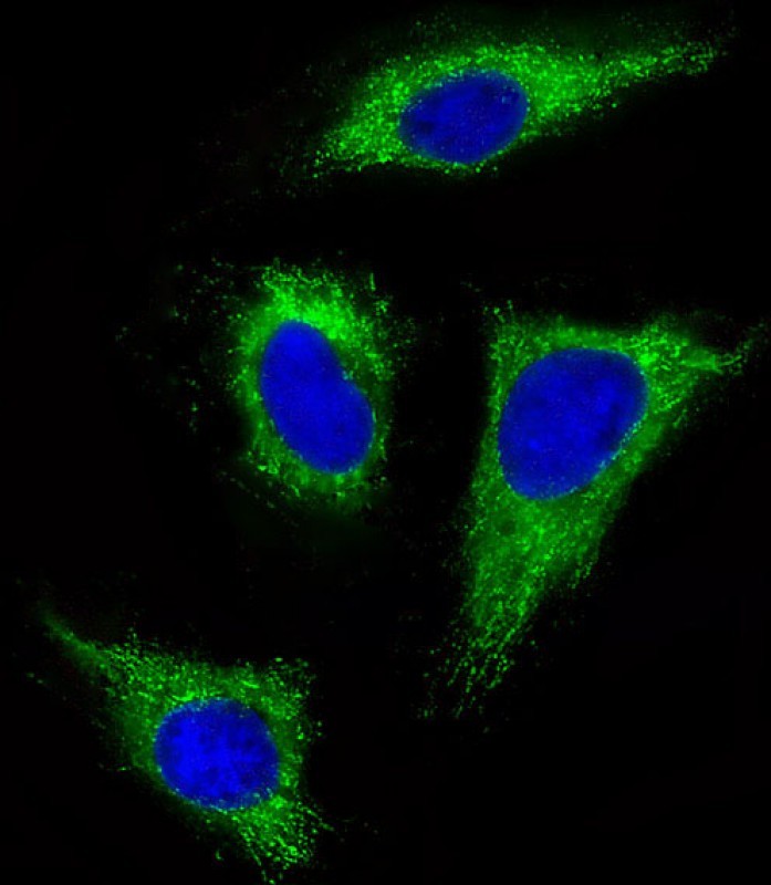 Paraformaldehyde-fixed, 0. 1% Triton X-100 permeabilized Hela cells; antibody incubation with FGFR1 (4C3) Monoclonal Antibody, unconjugated (bsm-51288M) at 1:25, followed by a conjugated secondary and DAPI for nuclei staining.