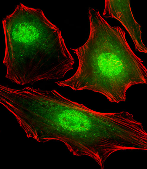 Hela cells stained with FUBP3 (12C8) Monoclonal Antibody, bsm-51416M at 1:25 dilution, followed by Alexa Fluor 488-conjugated goat anti-mouse lgG (green). Cytoplasmic actin was counterstained with Alexa Fluor® 555 conjugated with Phalloidin (red).