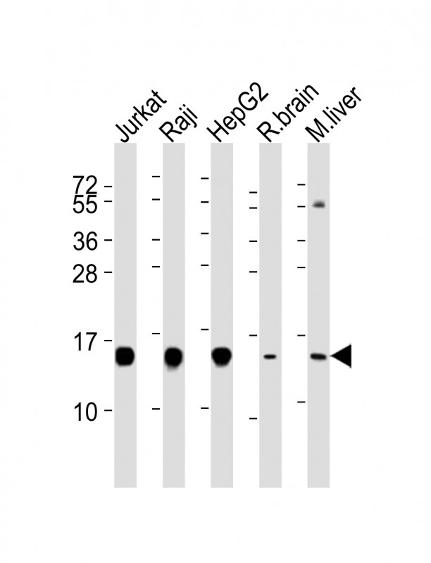Lane 1: Jurkat; Lane 2: Raji; Lane 3: HepG2; Lane 4: Rat Brain lysates; Lane 5: Mouse Liver lysates; probed with HINT1 (5C3) Polyclonal Antibody, unconjugated (bsm-51304M) at 1:4000 overnight at 4°C followed by a conjugated secondary antibody for 60 minutes at 37°C.