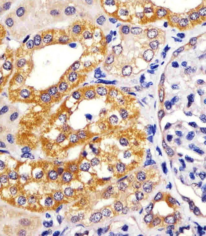 Paraformaldehyde-fixed, paraffin embedded human kidney tissue; Blocked with 3% BSA for 30min at RT; Antibody incubation with IRF3 (2C4) Monoclonal Antibody, Unconjugated (bsm-51312M) at 1:25 for 1hr at 37°C, followed by a conjugated secondary antibody and DAB staining.