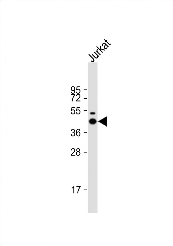 Jurkat cell lysates probed with LCK (6C6) Polyclonal Antibody, unconjugated (bsm-51313M) at 1:2000 overnight at 4°C followed by a conjugated secondary antibody for 60 minutes at 37°C.