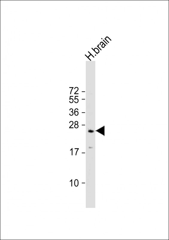 human brain lysates probed with RAB3A (5B7) Polyclonal Antibody, unconjugated (bsm-51311M) at 1:500 overnight at 4°C followed by a conjugated secondary antibody for 60 minutes at 37°C.