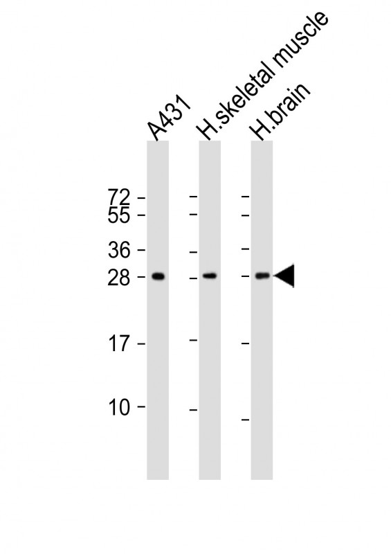 Lane 1: A431; Lane 2: human skeletal muscle lysates; Lane 3: human brain Cell lysates; probed with DENR (2C9) Polyclonal Antibody, unconjugated (bsm-51318M) at 1:1000 overnight at 4°C followed by a conjugated secondary antibody for 60 minutes at 37°C.