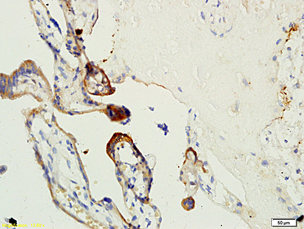 Formalin-fixed and paraffin embedded human placenta tissue labeled with Anti-Factor XIII Polyclonal Antibody, Unconjugated (bs-1587R) at 1:200 followed by conjugation to the secondary antibody, (SP-0023), and DAB staining