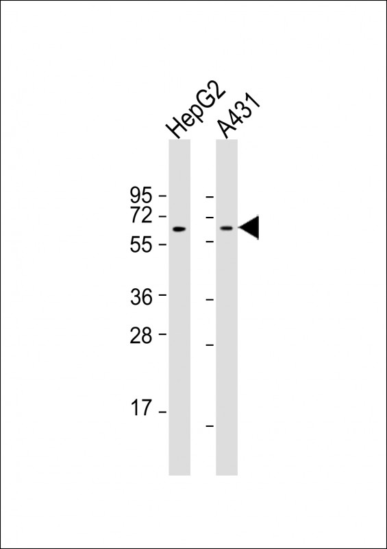 Lane 1: HepG2 cell lysates; Lane 2: A431 cell lysates; probed with TERF2IP (4C8) Polyclonal Antibody, unconjugated (bsm-51368M) at 1:2000 overnight at 4°C followed by a conjugated secondary antibody for 60 minutes at 37°C.