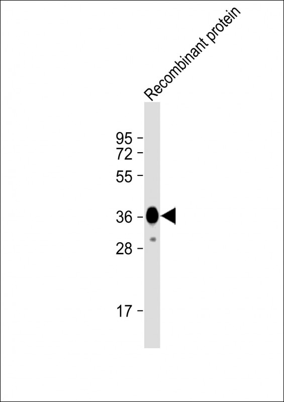 Recombinant protein lysates probed with MYO18B (3C5) Polyclonal Antibody, unconjugated (bsm-51376M) at 1:16000 overnight at 4°C followed by a conjugated secondary antibody for 60 minutes at 37°C.