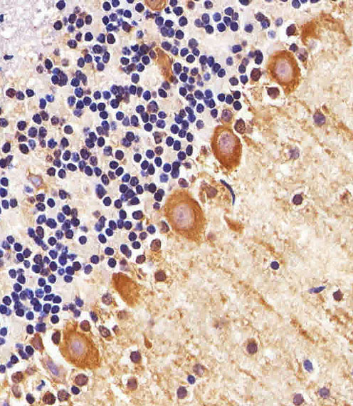 Paraformaldehyde-fixed, paraffin embedded mouse cerebellum tissue; Blocked with 3% BSA for 30min at RT; Antigen retrieval via heat mediation with a citrate buffer (pH6); Antibody incubation with PPT1 (10G4) Monoclonal Antibody, Unconjugated (bsm-51262M) at 1:25 for 1hr at 37°C, followed by a conjugated secondary antibody and DAB staining.
