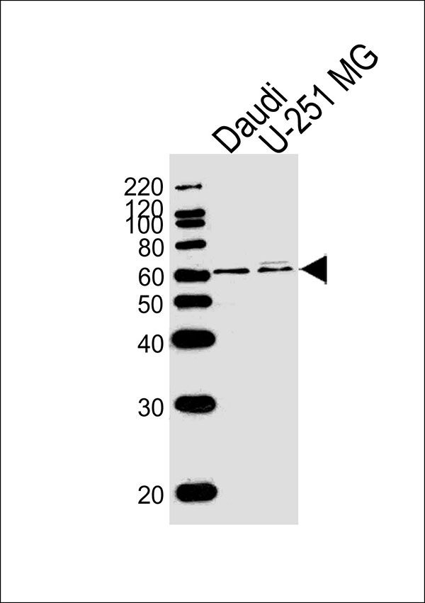 Lane 1: Daudi cell lysates; Lane 2: U-251 cell lysates; probed with YY1 (3C6) Polyclonal Antibody, unconjugated (bsm-51412M) at 1:1000 overnight at 4°C followed by a conjugated secondary antibody for 60 minutes at 37°C.