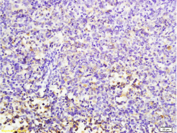 Formalin-fixed and paraffin embedded mouse lymphoma labeled with Anti-MuRF1/Trim63 Polyclonal Antibody, Unconjugated (bs-1520R) at 1:200 followed by conjugation to the secondary antibody and DAB staining.