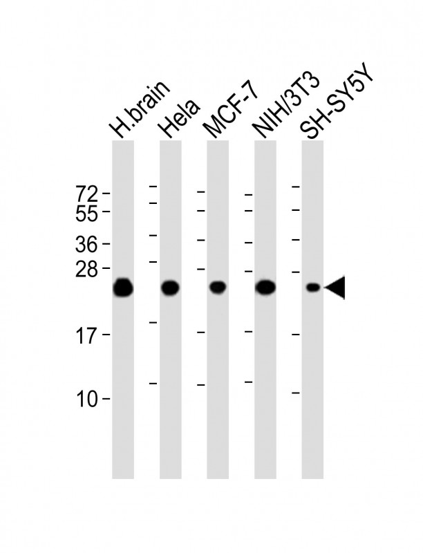 Lane 1: human brain lysate; Lane 2: Hela cell lysate; Lane 3: MCF-7 cell lysate; Lane 4: NIH/3T3 cell lysate; Lane 5: SH-SY5Y cell lysate; probed with SODM (9C3) Polyclonal Antibody, unconjugated (bsm-51319M) at 1:2000 overnight at 4°C followed by a conjugated secondary antibody for 60 minutes at 37°C.