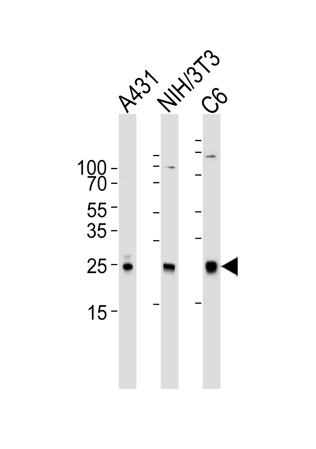 Lane 1: A431; Lane 2: NIH/3T3; Lane 3: C6 cell lysate probed with RAC1 (13C4) Monoclonal Antibody (bsm-51282M) at 1:1000 overnight at 4°C followed by a conjugated secondary antibody for 60 minutes at 37°C.