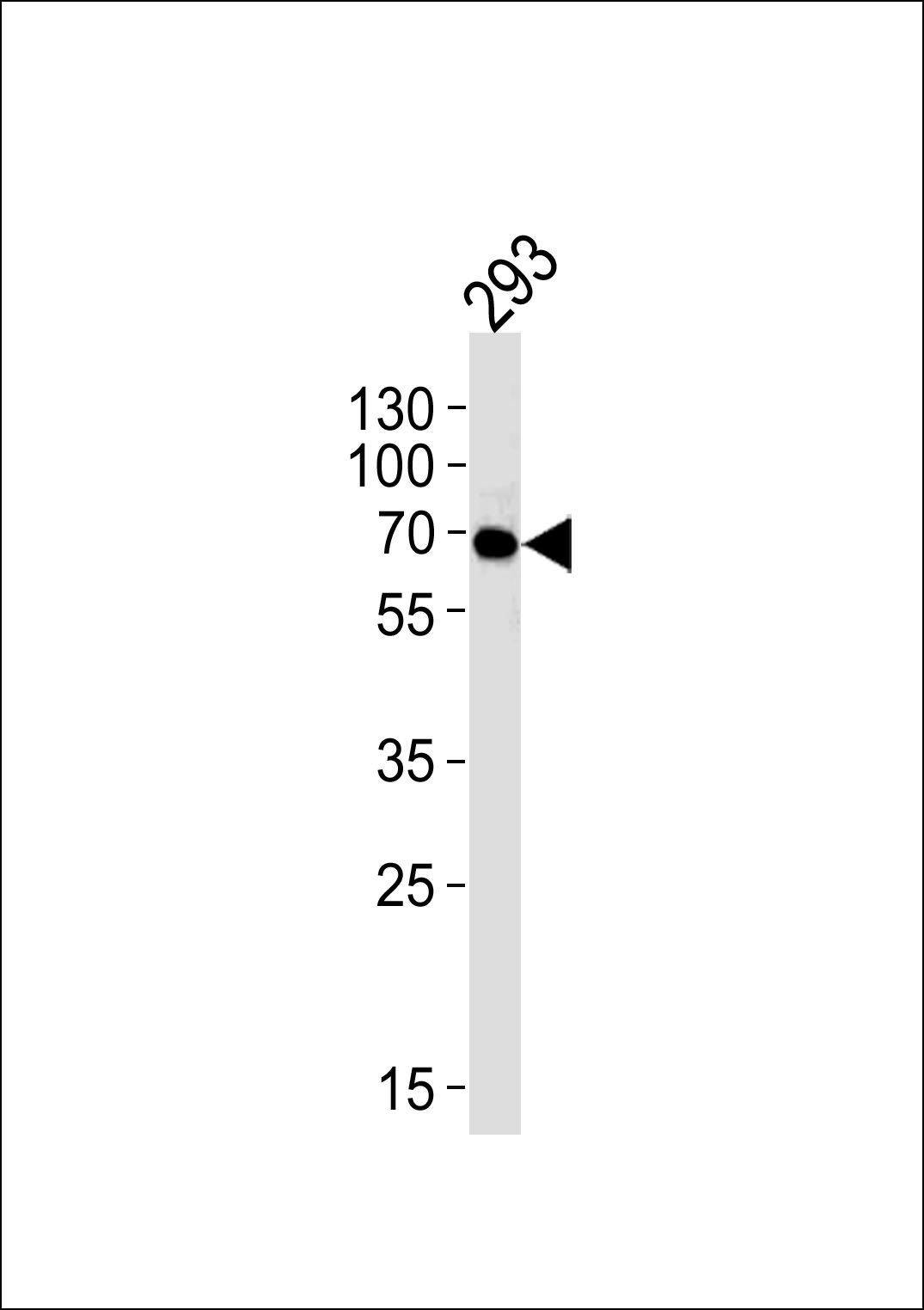 293 cells probed with FYN (2C7) Monoclonal Antibody, unconjugated (bsm-51263M) at 1:1000 overnight at 4°C followed by a conjugated secondary antibody for 60 minutes at 37°C.