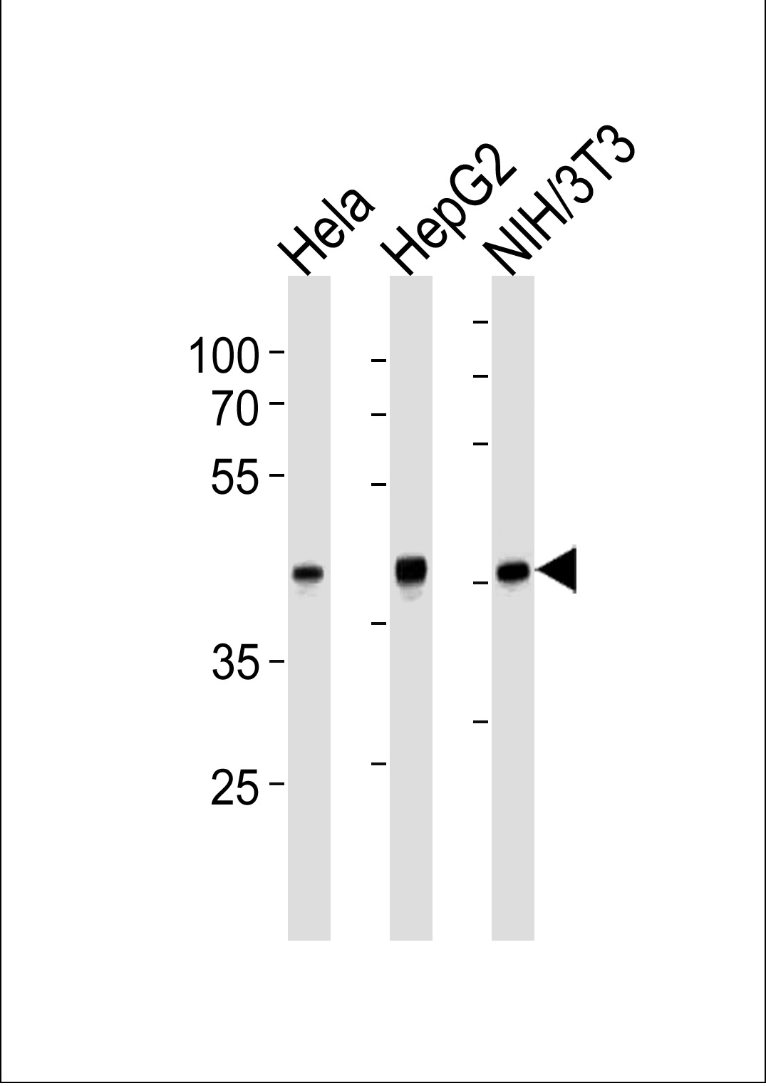 Lane 1: HeLa; Lane 2: HepG2; Lane 3: HIN/3T3 cell lysate probed with TBP (8C4) Monoclonal Antibody (bsm-51220M) at 1:1000 overnight at 4˚C. Followed by conjugation to secondary antibody (bs-0295G-HRP) at 1:3000 for 90 min at 37˚C.