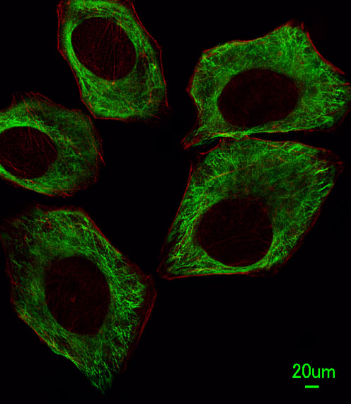 A549 cells stained with TBB5 (7D3) Monoclonal Antibody (bsm-51387M) at 1:25 dilution, followed by Alexa Fluor 488-conjugated secondary antibody (green), cytoplasmic actin (red).