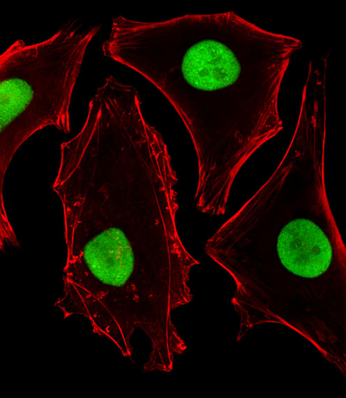 HeLa cells stained with SUMO2 (7A3) Monoclonal Antibody (bsm-51241M) at 1:25 dilution, followed by Alexa Fluor 488-conjugated secondary antibody (green), cytoplasmic actin (red).