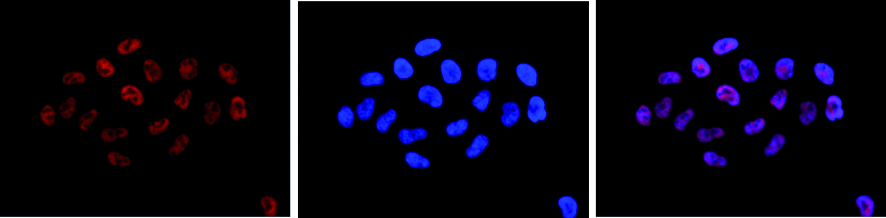 HeLa cells were stained with H3K4me3 (2G10) Monoclonal Antibody (Cat. No. bsm-53015M) and with DAPI. Cells were fixed with 4% formaldehyde for 10’ and blocked with PBS/TX-100 containing 5% normal goat serum and 1% BSA. The cells were labelled with the H3K4me3 antibody (left) diluted 1:500 in blocking solution followed by an anti-mouse antibody conjugated to Alexa594. The middle panel shows staining of the nuclei with DAPI. A merge of the two staining is shown on the right.