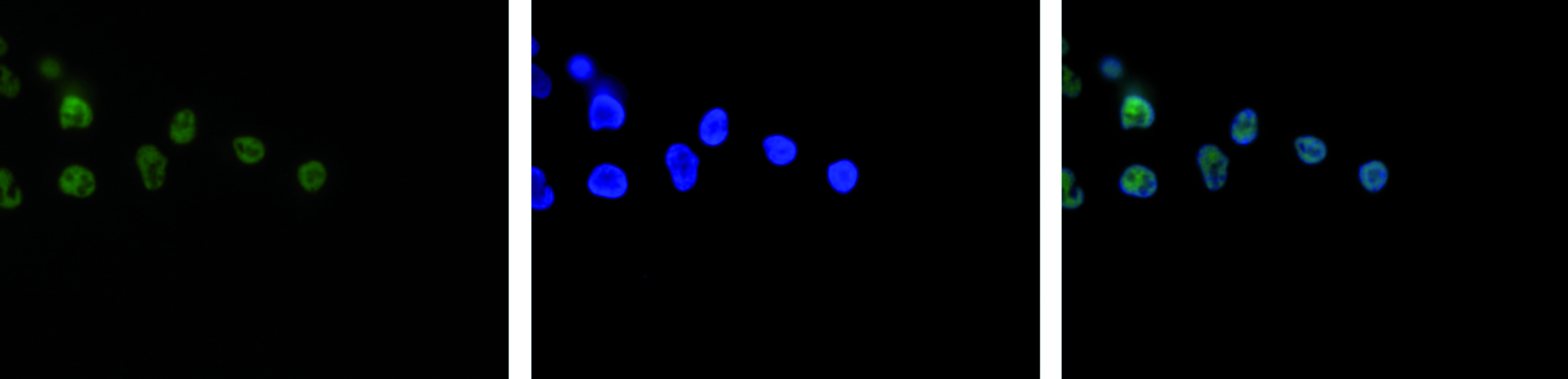HeLa cells were stained with the H3K4me3 antibody (bs-53034R) and with DAPI. Cells were fixed with 4% formaldehyde for 10’ and blocked with PBS/TX-100 containing 5% normal goat serum and 1% BSA. The cells were labelled with the H3K4me3 antibody (left) diluted 1:500 in blocking solution followed by an anti-rabbit antibody conjugated to Alexa488. The middle panel shows staining of the nuclei with DAPI. A merge of the two stainings is shown on the right.