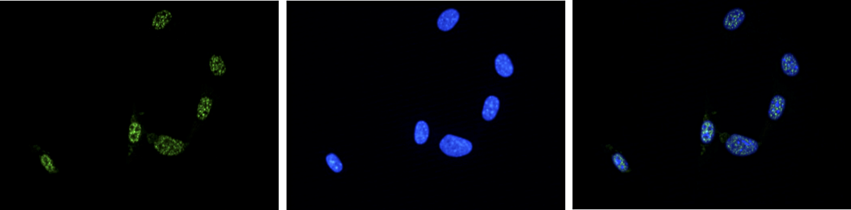 NIH3T3 cells were stained with the Ash2 antibody (bs-53055R) and with DAPI. Cells were fixed with 4% formaldehyde for 10’ and blocked with PBS/TX-100 containing 5% normal goat serum and 1% BSA. The cells were immunofluorescently labelled with the Ash2 antibody (left) diluted 1:200 in blocking solution followed by an anti-rabbit antibody conjugated to Alexa488. The middle panel shows staining of the nuclei with DAPI. A merge of the two is shown on the right.