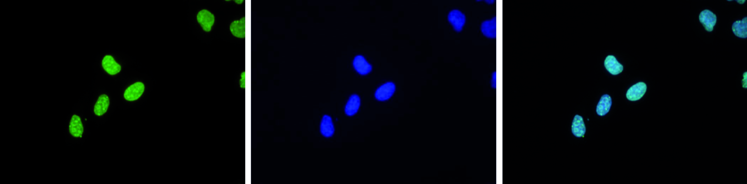 HeLa cells were stained with the Bioss antibody against H3K9me3 (bs-53114R) and with DAPI. Cells were fixed with 4% formaldehyde for 10’ and blocked with PBS/TX-100 containing 5% normal goat serum and 1% BSA. The cells were immunofluorescently labeled with the H3K9me3 antibody (middle) diluted 1:1,000 in blocking solution followed by an anti-rabbit antibody conjugated to Alexa488. The left panel shows staining of the nuclei with DAPI. A merge of both stainings is shown on the right.