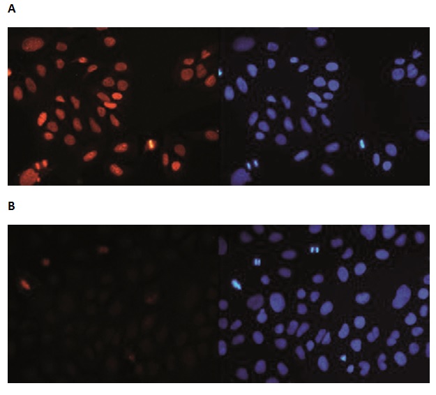 Human osteosarcoma (U2OS) cells were stained with the Bioss antibody against H4K20me3 (Cat. No. bs-53115R) and with DAPI. Cells were fixed with ice-cold methanol for 10’ and blocked with PBS/TX-100 containing 5% normal goat serum. Figure A: cells were immunofluorescently labeled with the H4K20me3 antibody (left) diluted 1:300 in blocking solution followed by an anti-rabbit secondary antibody conjugated to Alexa568 or with DAPI (right). Figure B: staining of the cells with the H4K20me3 antibody after incubation of the antibody with blocking peptide at 5 ng/μl.