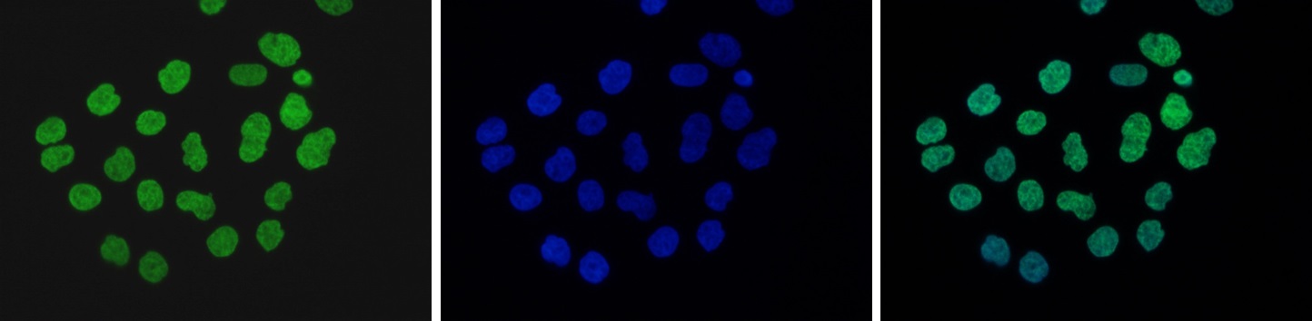 Mouse NIH3T3 cells were stained with the Bioss antibody against H3K9me2 (Cat. No. bs-53118R) and with DAPI. Cells were fixed with 4% formaldehyde for 10’ and blocked with PBS/TX-100 containing 5% normal goat serum and 1% BSA. The cells were immunofluorescently labeled with the H3K9me2 antibody (left) diluted 1:500 in blocking solution followed by an anti-rabbit antibody conjugated to Alexa488. The middle panel shows staining of the nuclei with DAPI. A merge of the two stainings is shown on the right.