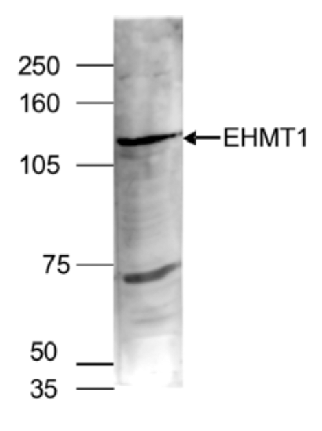 Nuclear extracts of HeLa cells (40 μg) were analyzed by Western blot using the EHMT1 antibody (bs-53068R) diluted 1:1,000 in TBS-Tween containing 5% skimmed milk. The position of the protein of interest is indicated on the right; the marker (in kDa) is shown on the left. The smaller fragment may represent a splicing variant.