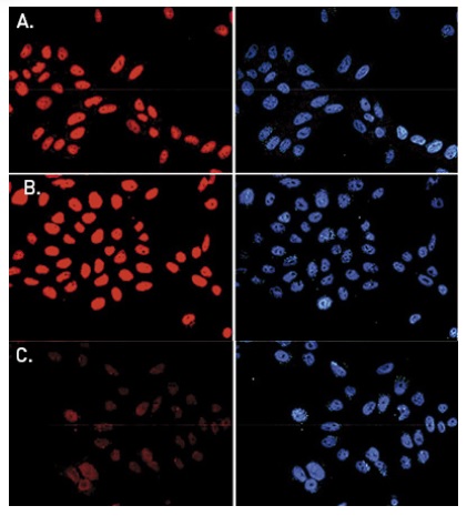 Human osteosarcoma (U2OS) cells were stained with the Bioss antibody against H3K79me3 (Cat. No. bs-53121R) and with DAPI. Cells were fixed with 2.5% formaldehyde for 30’ and blocked with PBS/TX-100 containing 1% BSA. Figure A: cells were immunofluorescently labeled with the H3K79me3 antibody (left) diluted 1:300 in blocking solution followed by an anti-rabbit antibody conjugated to Alexa568 or with DAPI (right). Figure B and C: staining of the cells with the H3K79me3 antibody after incubation of the antibody with 2 ng/μl H4K20me3 and H3K79me3 peptide, respectively.