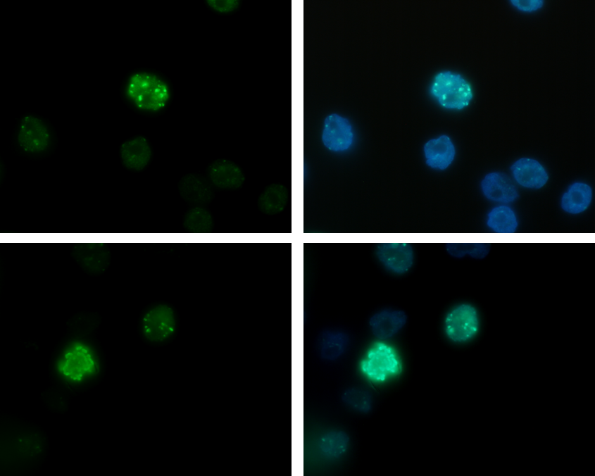 Hela cells were stained with the H3K27me3S28p antibody (bs-53053R) and with DAPI. Cells were fixed with formaldehyde, permeabilized with sodium citrate and Triton X100 and blocked with PBS containing 2.5% BSA. Left side: cells were immunofluorescently labelled with the H3K27me3S28p antibody (diluted 1:200 and incubated for 1 hour at room temperature) followed by goat anti-rabbit antibody conjugated to DyLight 488. Right side: the nuclei were stained with DAPI, which specifically labels DNA. Phosphorylation of H3 on serine 28 is increased during late G2 phase and reaches a maximum in metaphase cells. This may explain the different staining intensities of different cells.