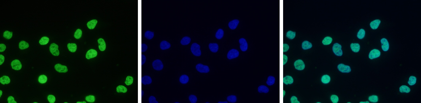 HeLa cells were stained with the H3K36me2 antibody (bs-53071R) and with DAPI. Cells were fixed with 4% formaldehyde for 10’ and blocked with PBS/TX-100 containing 5% normal goat serum and 1% BSA. The cells were immunofluorescently labelled with the H3K36me2 antibody (left) diluted 1:500 in blocking solution followed by an anti-rabbit antibody conjugated to Alexa488. The middle panel shows staining of the nuclei with DAPI. A merge of the two stainings is shown on the right.