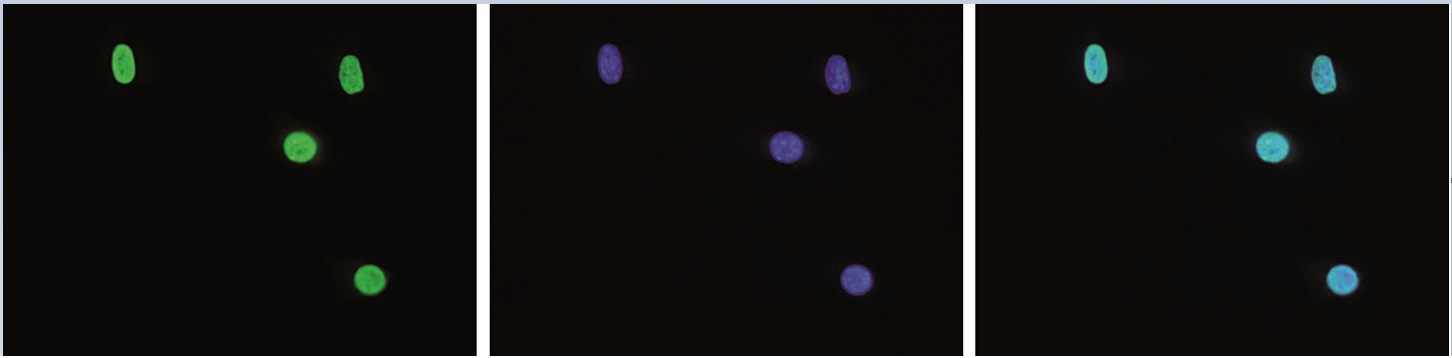 Mouse NIH3T3 cells were stained with the Bioss antibody against H3K27me3 (Cat. No. bs-53122R) and with DAPI. Cells were fixed with 4% formaldehyde for 10’ and blocked with PBS/TX-100 containing 5% normal goat serum and 1% BSA. The cells were immunofluorescently labeled with the H3K27me3 antibody (left) diluted 1:200 in blocking solution followed by an anti-rabbit antibody conjugated to Alexa488. The middle panel shows staining of the nuclei with DAPI. A merge of the two stainings is shown on the right. Mouse NIH3T3 cells were stained with the Bioss antibody against H3K27me3 (Cat. No. bs-53122R) and with DAPI. Cells were fixed with 4% formaldehyde for 10’ and blocked with PBS/TX-100 containing 5% normal goat serum and 1% BSA. The cells were immunofluorescently labeled with the H3K27me3 antibody (left) diluted 1:200 in blocking solution followed by an anti-rabbit antibody conjugated to Alexa488. The middle panel shows staining of the nuclei with DAPI. A merge of the two stainings is shown on the right.