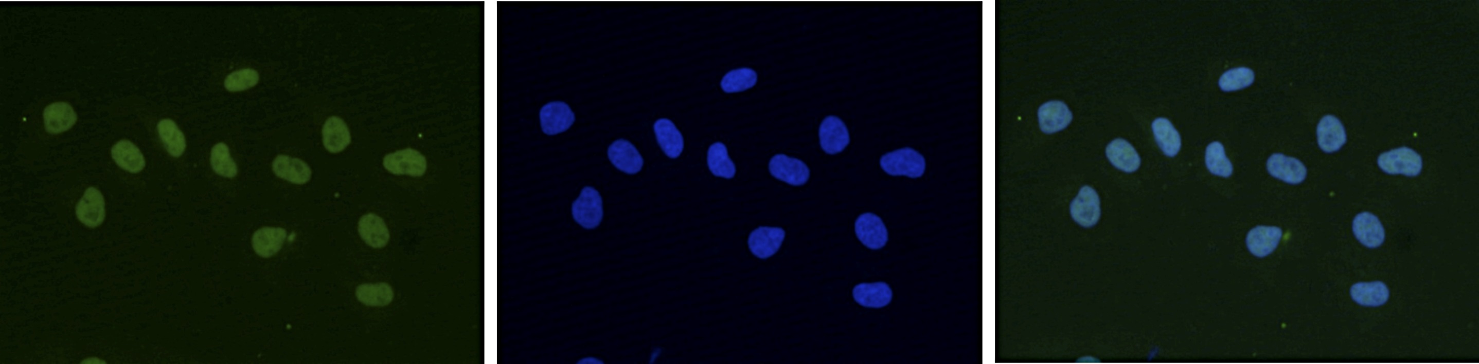 HeLa cells were stained with the Bioss antibody against HP1α (Cat. No. bs-53123R) and with DAPI. Cells were fixed with 4% formaldehyde for 10’ and blocked with PBS/TX-100 containing 5% normal goat serum and 1% BSA. The cells were immunofluorescently labeled with the HP1α antibody (left) diluted 1:500 in blocking solution followed by an anti-rabbit antibody conjugated to Alexa488. The middle panel shows staining of the nuclei with DAPI. A merge of the two stainings is shown on the right.