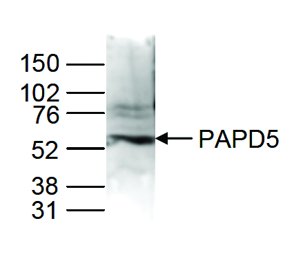 Nuclear extracts of HeLa cells (40 μg) were analyzed by Western blot using the antibody against PAPD5 (bs-53073R) diluted 1:1,000 in TBS-Tween containing 5% skimmed milk. The position of the protein of interest is indicated on the right (expected size: 63 kDa); the marker (in kDa) is shown on the left.