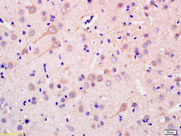 Formalin-fixed and paraffin embedded rat brain labeled with Anti-ADCY1 Polyclonal Antibody, Unconjugated (bs-3681R) at 1:200 followed by conjugation to the secondary antibody and DAB staining.