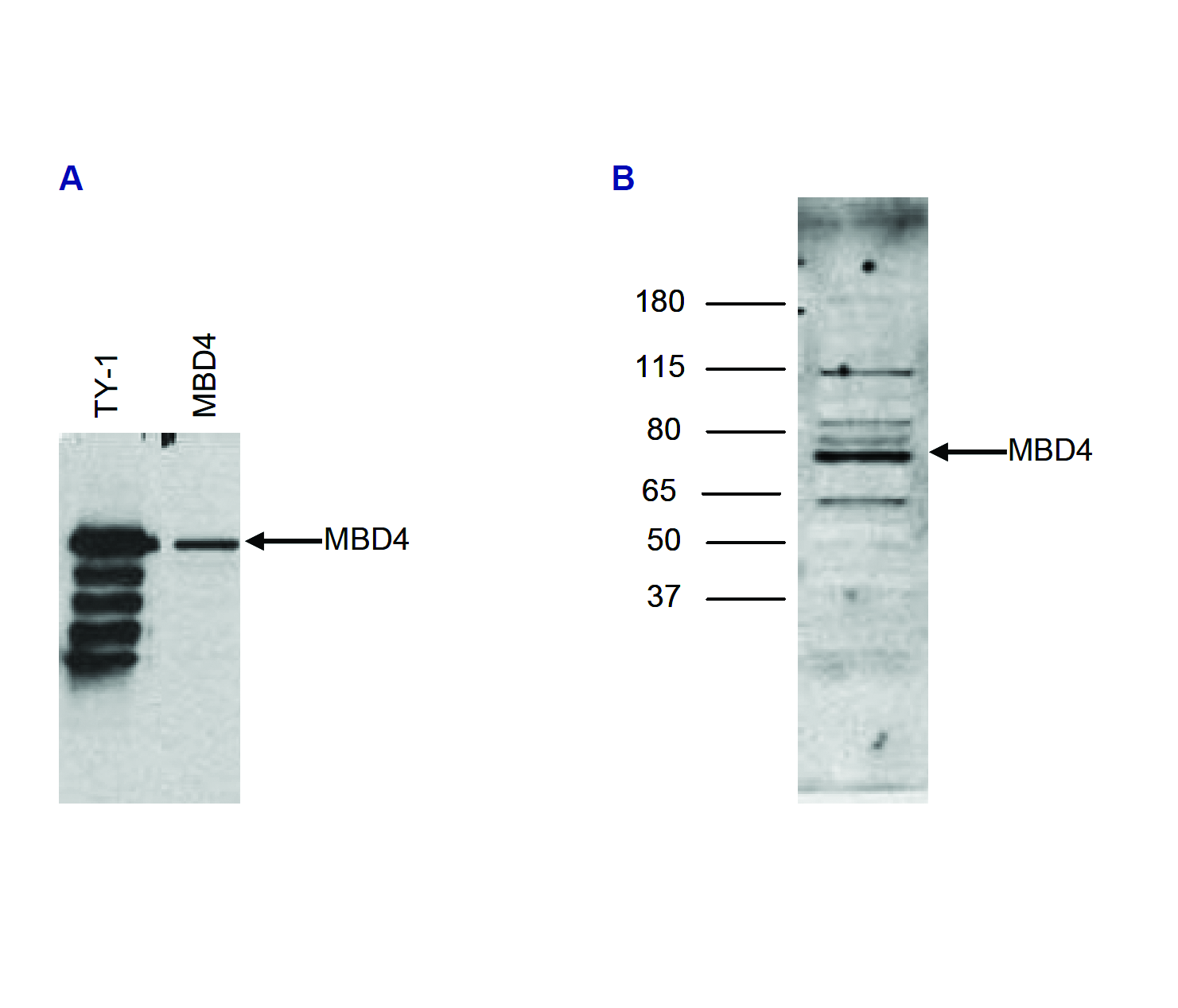 (Left) U2OS cells were transfected with an expression vector for TY1-tagged MBD4. The presence of TY1-MBD4 in the cell lysates was demonstrated by western blot analysis with the antibody against the TY1-tag (lane 1) and with the antibody against MBD4 (bs-53050R) (lane 2), diluted 1:2,000 in TBST containing 3% milk powder. (Right) Western blot was performed on nuclear extracts from the U937 human leukemic monocyte lymphoma cell line (40 μg) with the antibody against MBD4 (bs-53050R), diluted 1:2,000 in TBST containing 3% milk powder.